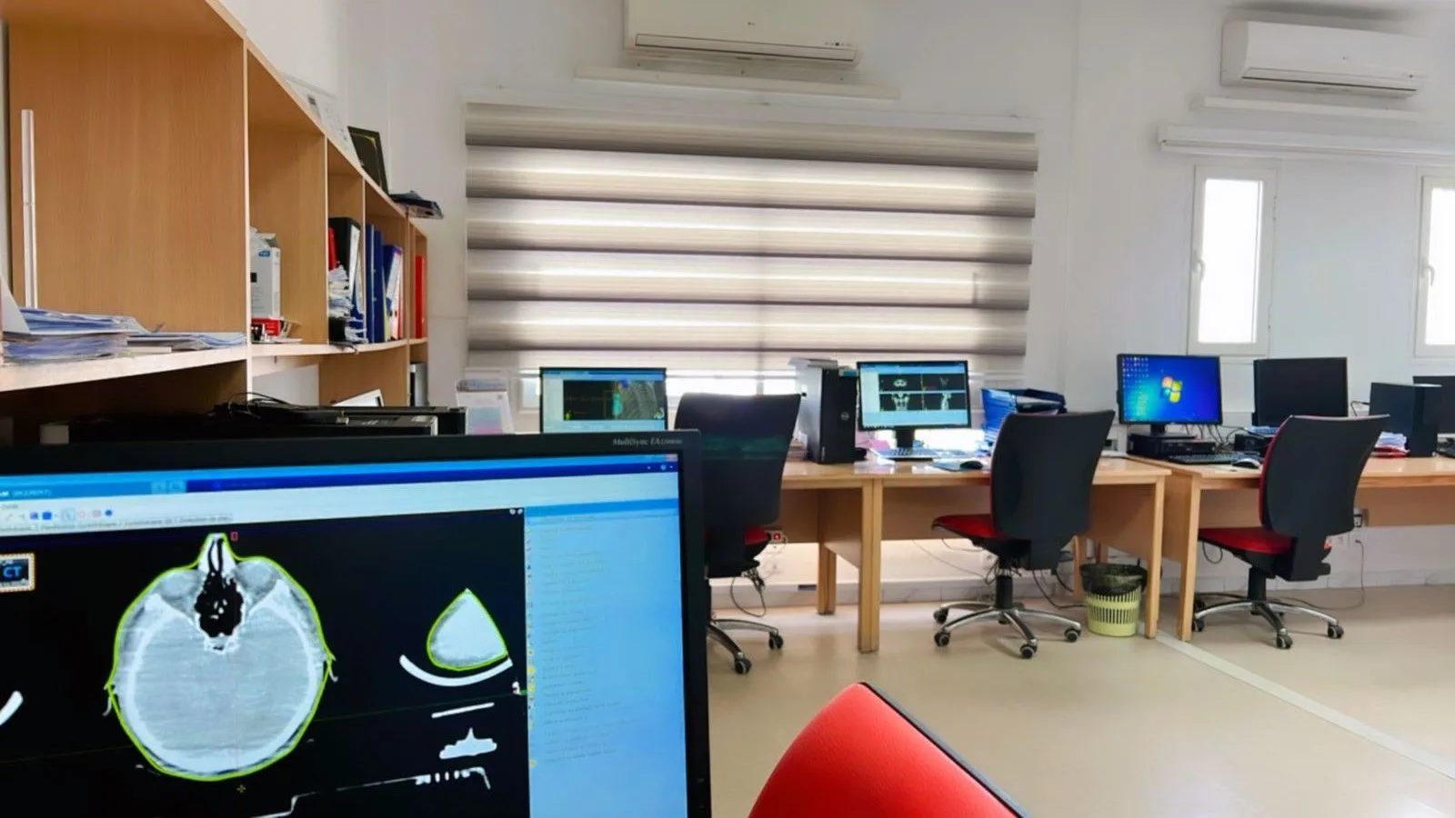 Radiothérapie au centre Médical Ibn Khaldoun Tunisie
